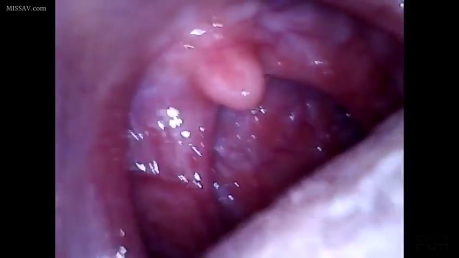 室内 · 唾液 · 口腔内部视角 · 深喉